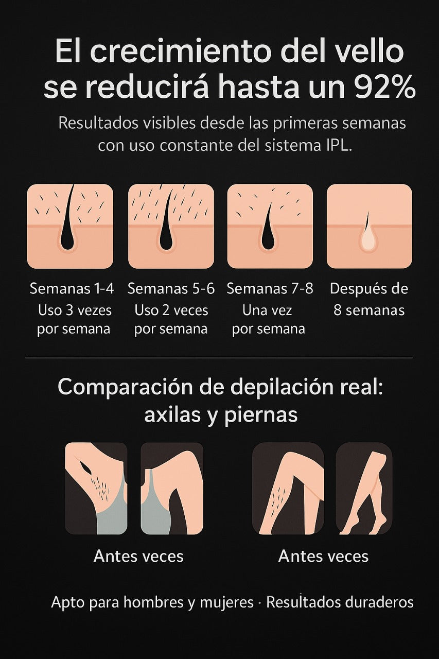 Depiladora Láser Hairless de luz  I.P.L
